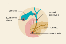 Jak pročistit žlučovody