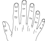 Vrásčitá pokožka rukou